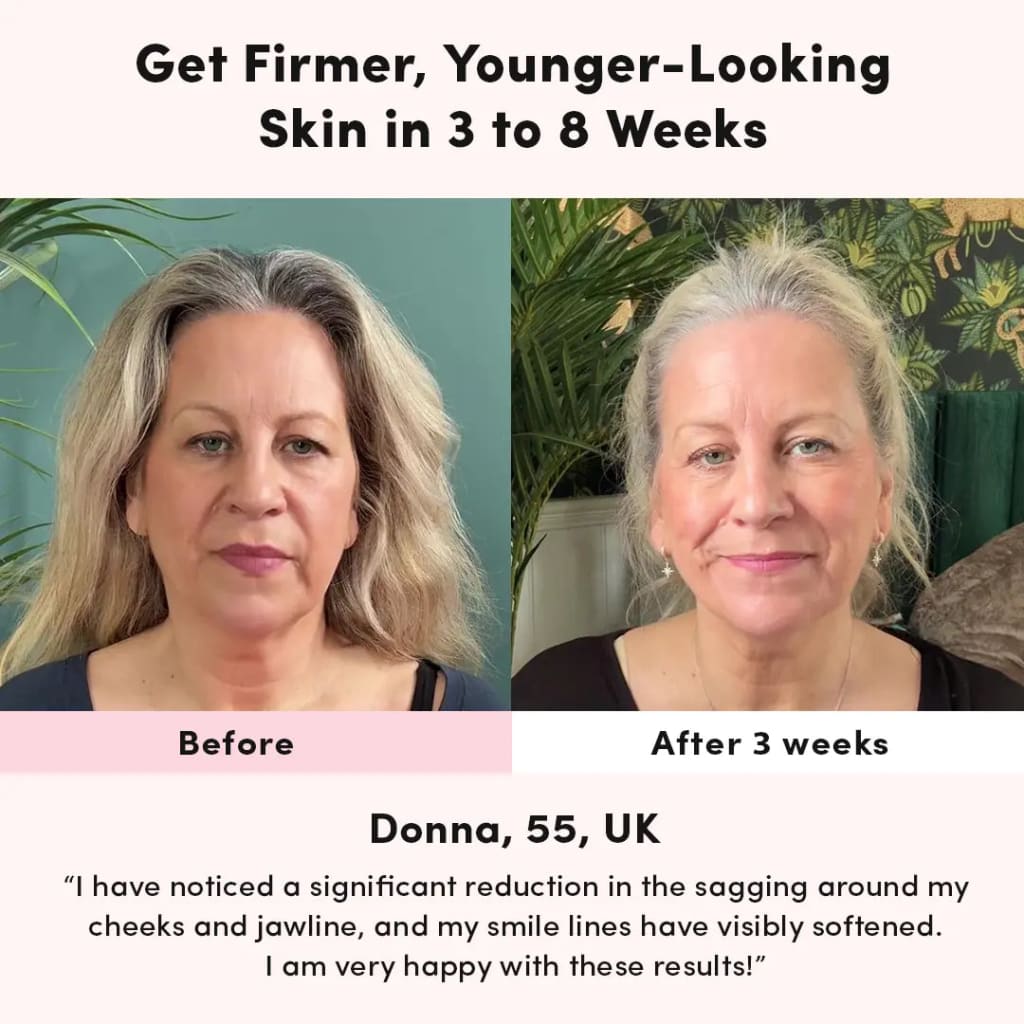 LUNA&SKIN RegenMask™